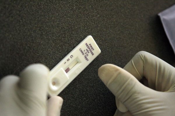 A total of 62,250 new cases of HIV have been registered in the past 11 months - Sputnik International