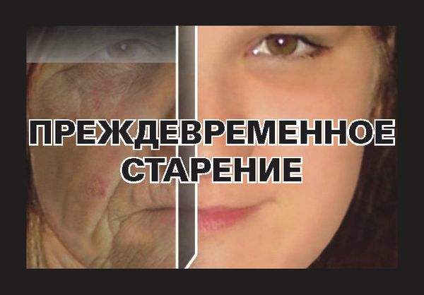 Scary Pictures Unlikely to Dissuade Russian Smokers - Sputnik International