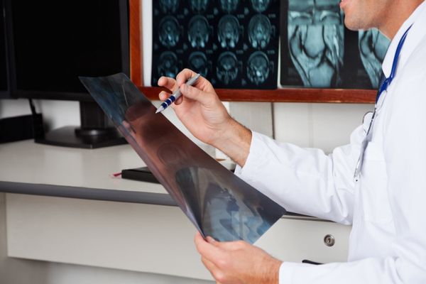 Doctor studying tumor X-rays - Sputnik International