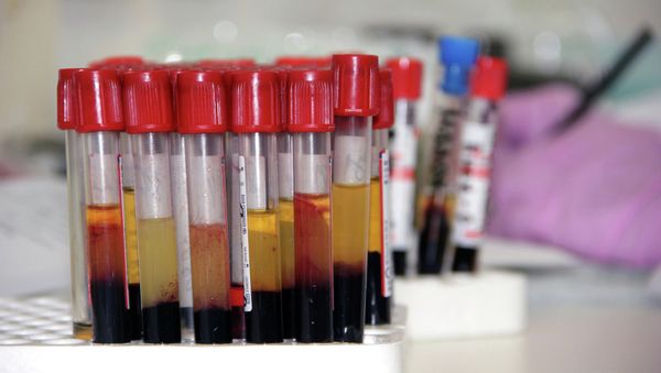 Ampoules with blood tests - Sputnik International
