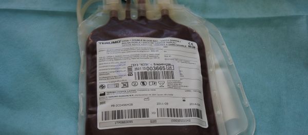 The US Food and Drug Administration (FDA) is proposing to change the limits on blood donations from homosexual men from a life ban to a one-year deferral The US Food and Drug Administration (FDA) is proposing to change the limits on blood donations from homosexual men from a life ban to a one-year deferral - Sputnik International