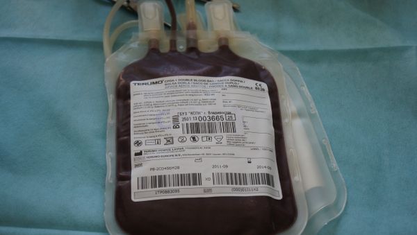 The US Food and Drug Administration (FDA) is proposing to change the limits on blood donations from homosexual men from a life ban to a one-year deferral - Sputnik International