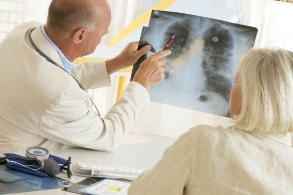 An official of the International Union Against Tuberculosis and Lung Disease stressed that e-cigarettes also contain nicotine and can cause addiction. - Sputnik International