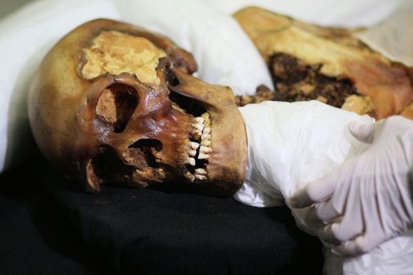 The ancient Pazyryk princess discovered by Russian scientists about two decades ago in the Altai Mountains suffered from breast cancer, having used cannabis to relieve the pain, scientists have revealed. - Sputnik International